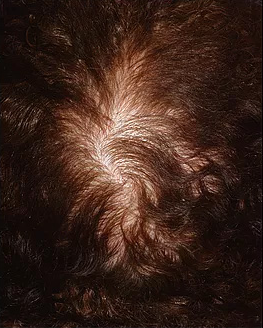 revivogen scalp therapy